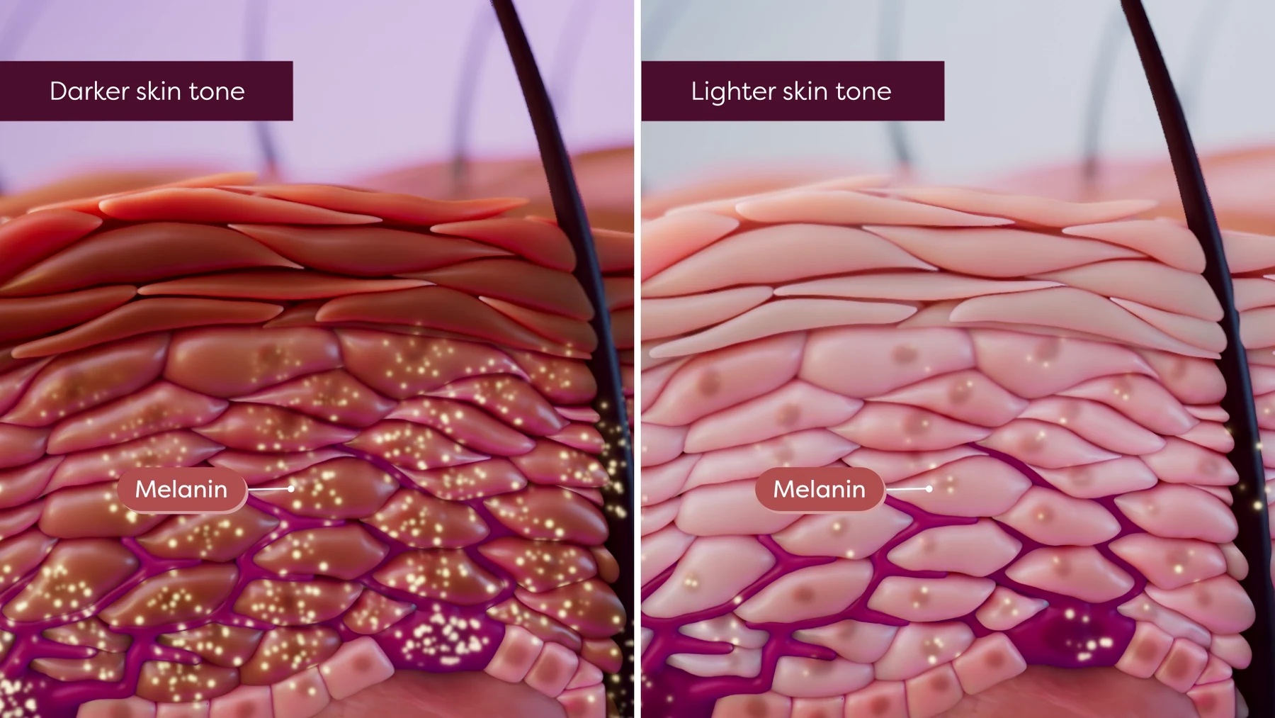 Side-by-side skin cross-sections showing different amounts of melanin